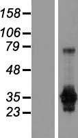 GAS2 Protein - Western validation with an anti-DDK antibody * L: Control HEK293 lysate R: Over-expression lysate