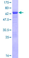 GAS2 Protein - 12.5% SDS-PAGE of human GAS2 stained with Coomassie Blue