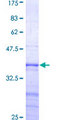 GAS2L3 Protein - 12.5% SDS-PAGE Stained with Coomassie Blue.