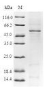 GAS41 Protein - (Tris-Glycine gel) Discontinuous SDS-PAGE (reduced) with 5% enrichment gel and 15% separation gel.