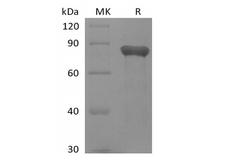 GAS6 Protein - Recombinant Human GAS6 (C-6His)