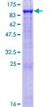 GAS6 Protein - 12.5% SDS-PAGE of human GAS6 stained with Coomassie Blue