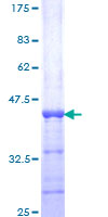 GAS6 Protein - 12.5% SDS-PAGE Stained with Coomassie Blue.