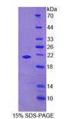 GAS6 Protein - Recombinant Growth Arrest Specific Protein 6 (GAS6) by SDS-PAGE