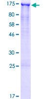 GASP2 / GPRASP2 Protein - 12.5% SDS-PAGE of human GPRASP2 stained with Coomassie Blue