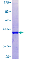 Gastric Inhibitory Peptide Protein - 12.5% SDS-PAGE of human GIP stained with Coomassie Blue
