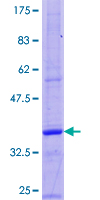 Gastrin Protein - 12.5% SDS-PAGE of human GAST stained with Coomassie Blue