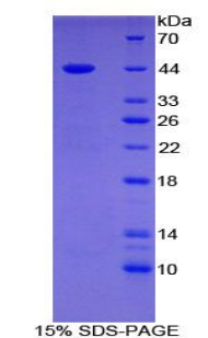 Gastrin Protein - Recombinant Gastrin By SDS-PAGE