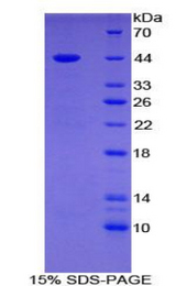 Gastrin Protein - Recombinant Gastrin By SDS-PAGE