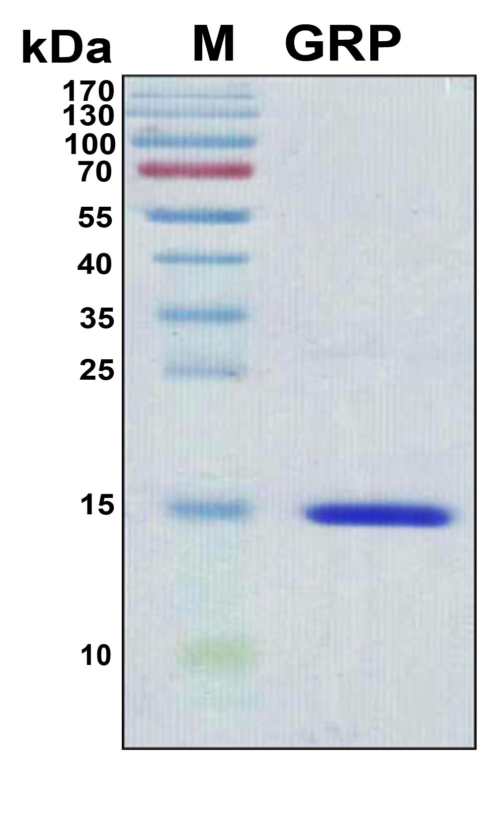 Gastrin Releasing Peptide Protein - SDS-PAGE under reducing conditions and visualized by Coomassie blue staining