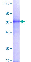 GATA1 Protein - 12.5% SDS-PAGE of human GATA1 stained with Coomassie Blue