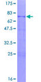 GATA1 Protein - 12.5% SDS-PAGE of human GATA1 stained with Coomassie Blue