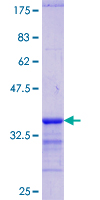 GATA1 Protein - 12.5% SDS-PAGE Stained with Coomassie Blue.