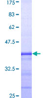 GATA2 Protein - 12.5% SDS-PAGE Stained with Coomassie Blue.