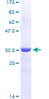 GATA3 Protein - 12.5% SDS-PAGE Stained with Coomassie Blue.