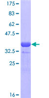 GATA4 Protein - 12.5% SDS-PAGE Stained with Coomassie Blue