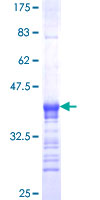 GATA5 Protein - 12.5% SDS-PAGE Stained with Coomassie Blue.