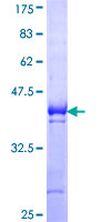 GATA6 Protein - 12.5% SDS-PAGE Stained with Coomassie Blue.