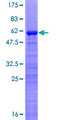 GATAD1 Protein - 12.5% SDS-PAGE of human GATAD1 stained with Coomassie Blue