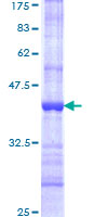 GATAD1 Protein - 12.5% SDS-PAGE Stained with Coomassie Blue.