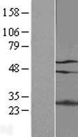 GATAD2A Protein - Western validation with an anti-DDK antibody * L: Control HEK293 lysate R: Over-expression lysate