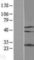 GATAD2A Protein - Western validation with an anti-DDK antibody * L: Control HEK293 lysate R: Over-expression lysate