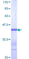 GATAD2B Protein - 12.5% SDS-PAGE Stained with Coomassie Blue.
