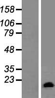 GATC Protein - Western validation with an anti-DDK antibody * L: Control HEK293 lysate R: Over-expression lysate