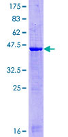 GATC Protein - 12.5% SDS-PAGE of human GATC stained with Coomassie Blue