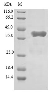 GATC Protein - (Tris-Glycine gel) Discontinuous SDS-PAGE (reduced) with 5% enrichment gel and 15% separation gel.