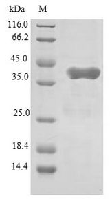 GATC Protein - (Tris-Glycine gel) Discontinuous SDS-PAGE (reduced) with 5% enrichment gel and 15% separation gel.