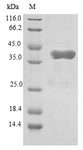 GATC Protein - (Tris-Glycine gel) Discontinuous SDS-PAGE (reduced) with 5% enrichment gel and 15% separation gel.