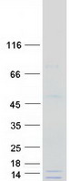 GATC Protein - Purified recombinant protein GATC was analyzed by SDS-PAGE gel and Coomassie Blue Staining