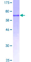 GATM / AGAT Protein - 12.5% SDS-PAGE of human GATM stained with Coomassie Blue