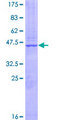 GATS Protein - 12.5% SDS-PAGE of human GATS stained with Coomassie Blue