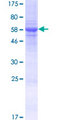 GATSL3 Protein - 12.5% SDS-PAGE of human LOC652968 stained with Coomassie Blue