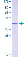 GAX / MEOX2 Protein - 12.5% SDS-PAGE Stained with Coomassie Blue.