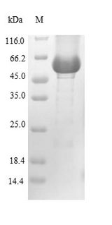 GBA / Glucosidase Beta Acid Protein - (Tris-Glycine gel) Discontinuous SDS-PAGE (reduced) with 5% enrichment gel and 15% separation gel.