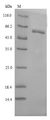 GBA / Glucosidase Beta Acid Protein - (Tris-Glycine gel) Discontinuous SDS-PAGE (reduced) with 5% enrichment gel and 15% separation gel.