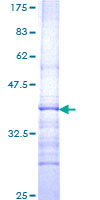 GBA / Glucosidase Beta Acid Protein - 12.5% SDS-PAGE Stained with Coomassie Blue.