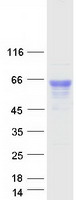 GBA / Glucosidase Beta Acid Protein - Purified recombinant protein GBA was analyzed by SDS-PAGE gel and Coomassie Blue Staining