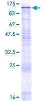 GBA2 Protein - 12.5% SDS-PAGE of human GBA2 stained with Coomassie Blue