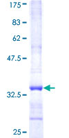 GBA3 / CBG Protein - 12.5% SDS-PAGE Stained with Coomassie Blue.