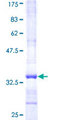 GBA3 / CBG Protein - 12.5% SDS-PAGE Stained with Coomassie Blue.