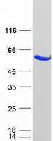 GBA3 / CBG Protein - Purified recombinant protein GBA3 was analyzed by SDS-PAGE gel and Coomassie Blue Staining