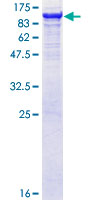 GBE1 Protein - 12.5% SDS-PAGE of human GBE1 stained with Coomassie Blue
