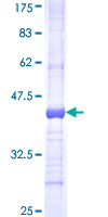 GBE1 Protein - 12.5% SDS-PAGE Stained with Coomassie Blue.