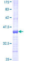 GBE1 Protein - 12.5% SDS-PAGE Stained with Coomassie Blue.
