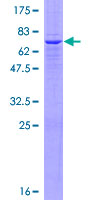 GBGT1 Protein - 12.5% SDS-PAGE of human GBGT1 stained with Coomassie Blue