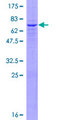 GBGT1 Protein - 12.5% SDS-PAGE of human GBGT1 stained with Coomassie Blue